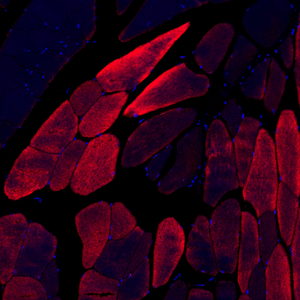 05 GB111556_alpha Actinin_M skeletal muscle_5367_d500_24.4x_red_IF.jpg