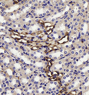 02 GB11409_cavedin-1_1214_121417120602_d1000_R kidney _40.0x_IHC.jpg