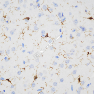 02 GB153502_20230724_IBA-1_ZSR230517_ZSR230517 M Brain d1000_40.0x_IHC.jpg