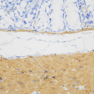 03 GB151220_20230724_smooth muscle Myosin heavy chain 11_ZSM20004_ZSM20004230521 M colon d500_40.0x_IHC.jpg