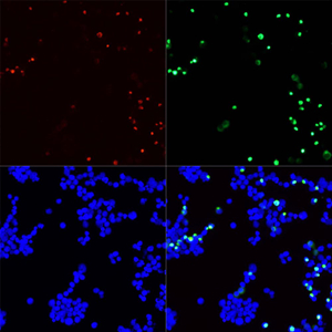 02 GB12019_20220724 V5 7D1B3 20230625 d1000_GFP-transfected  293 Anti-V5-tag_40X_ICC.jpg