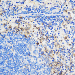 02 GB115601_20230724_Ly6C_C3040 02_C304023060602 M Inflammatory model induced by lps(6h) spleen d800_40.0x_IHC.jpg