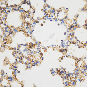 03 GB115601_20230724_Ly6C_C3040 02_C304023060602 M Inflammatory model induced by lps(6h) lung d800_40.0x_IHC.jpg