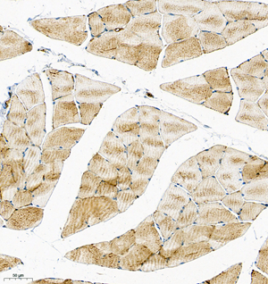 07 GB115598_RACBP1_14868-1_1486823011302-1 R skeletal muscle d150_IHC_20.0x.jpg