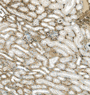 04 GB115592_SERPINA1_14814-2_1481423011302-2 M kidney d300_IHC_20.0x.jpg