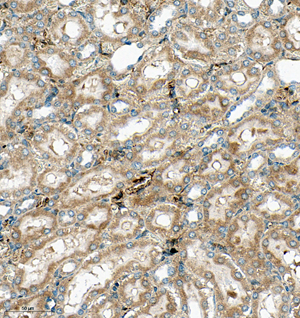 07 GB115592_SERPINA1_14814-2_1481423011302-2 R kidney d300_IHC_30.0x.jpg