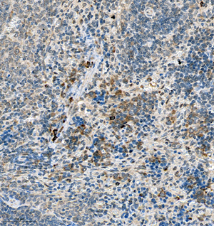 08 GB115592_SERPINA1_14814-2_1481423011302-2 R spleen d300_IHC_30.0x.jpg