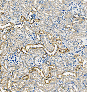 04 GB115593_SERPINA1_14814-2_1481423011302-2 M kidney d200_IHC_20.0x.jpg