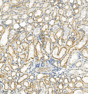 08 GB115593_SERPINA1_14814-2_1481423011302-2 R kidney d200_IHC_20.0x.jpg