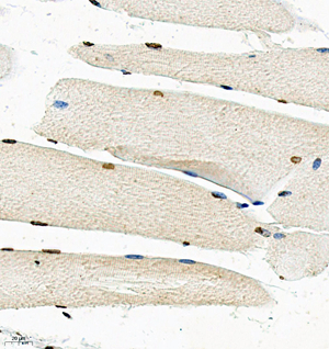 05 GB115595_RSK2_14841-2_1484123011302-2 M skeletal muscle d150_IHC_40.0x.jpg