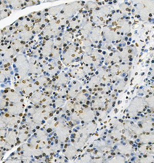 08 GB115595_RSK2_14841-2_1484123011302-2 R pancreas d150_IHC_30.0x.jpg