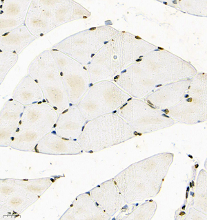 09 GB115595_RSK2_14841-2_1484123011302-2 R skeletal muscle d150_IHC_40.0x.jpg