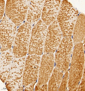 04 GB115590_sirt3_14783-3_1478322122702-3 M skeletal muscle d150_IHC_40.0x.jpg