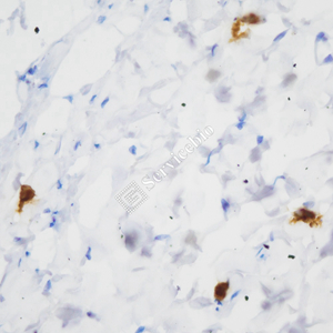 02 GB15110_20230724_Mast cell tryptase_ZSR22057_ZSR22057230517 M skin d1000_40.0x_IHC.jpg