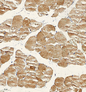 04 GB115580_20230720_TRAP1_13972-1_1397222072802-1 M skeletal muscle d150_IHC_20.0x.jpg