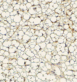 01 GB115581_Adiponectin_14200-3_1420022091202-3 M Brown fat d150_IHC_40.0x.jpg