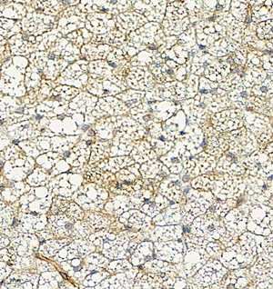 03 GB115581_Adiponectin_14200-3_1420022091202-3 R Brown fat d150_IHC_40.0x.jpg