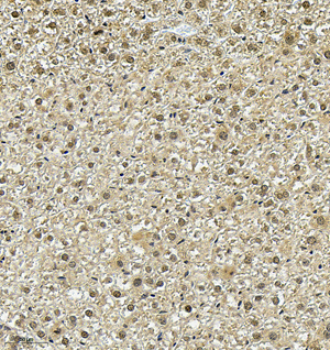 03 GB115583_AKT3_14331-2_1433122121302-2 M liver d200_IHC_30.0x.jpg