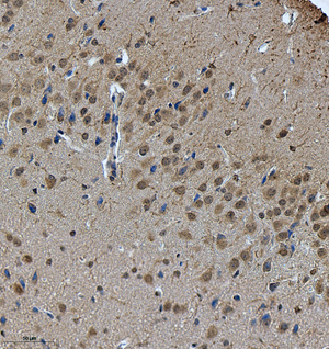 04 GB115583_AKT3_14331-2_1433122121302-2 M liver d200_IHC_40.0x.jpg