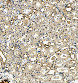 05 GB115583_AKT3_14331-2_1433122121302-2 R brain d200_IHC_30.0x.jpg