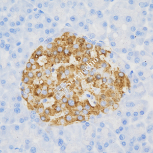 03 GB15336_20230724_Insulin_ZSR22096_ZSR22096230518 R pancreas d800_40.0x_IHC.jpg