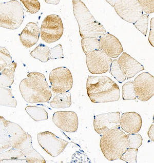 02 GB115587_FABP1_14744-2_1474422122702-2 M skeletal muscle d200_IHC_30.0x.jpg