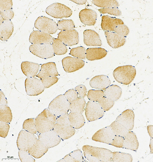 04 GB115587_FABP1_14744-2_1474422122702-2 R skeletal muscle d200_IHC_20.0x.jpg