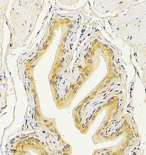 04 GB115588_CSTB_14778-2_1477822122702-2 M urinary bladder d150_IHC_30.0x.jpg