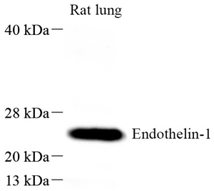 01 GB115574_Endothelin1_14788-2_WB.jpg