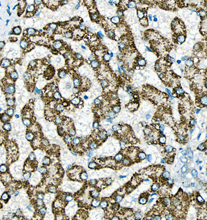 03 GB115577_Cathenapsinl_13959-3_1395922072802-3 H liver d150_IHC_40.0x.jpg