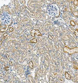 05 GB115577_Cathenapsinl_13959-3_1395922072802-3 M kidney d150_IHC_20.0x.jpg