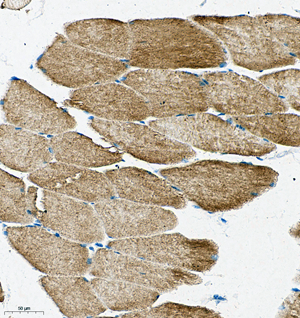 06 GB115577_Cathenapsinl_13959-3_1395922072802-3 M skeletal muscle d150_IHC_25.0x.jpg