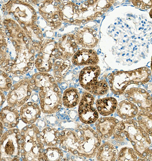 08 GB115577_Cathenapsinl_13959-3_1395922072802-3 R kidney d150_IHC_30.0x.jpg