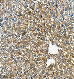 09 GB115577_Cathenapsinl_13959-3_1395922072802-3 R liver d150_IHC_20.0x.jpg