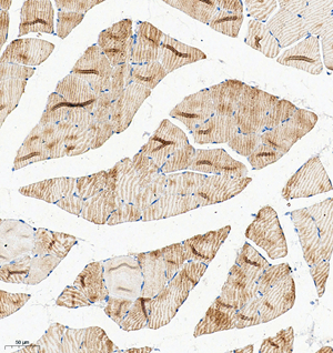 10 GB115577_Cathenapsinl_13959-3_1395922072802-3 R skeletal muscle d150_IHC_20.0x.jpg