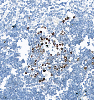 01 GB115578_AURKB_13961-1_1396122072802-1 R thymus gland d100_IHC_40.0x.jpg