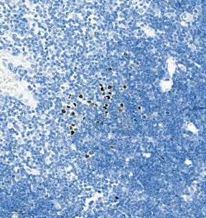 02 GB115578_AURKB_13961-1_1396122072802-1 R thymus gland d200_IHC_30.0x.jpg