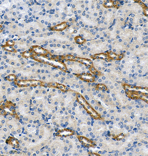 02 GB115579_CASR_13967-3_1396722072802-3 M kidney d150_IHC_30.0x.jpg