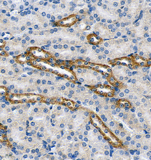 03 GB115579_CASR_13967-3_1396722072802-3 M kidney d150_IHC_40.0x.jpg