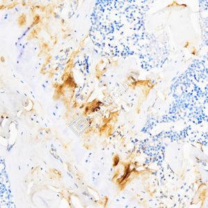 01 GB15021_CollagenII_ZSM17011_d1200_M bone_20.0x_IHC.png