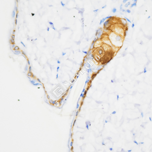 03 GB15803_Cytokeratin 14_ZSM19027_d1000_M skin_40.0x_IHC.png