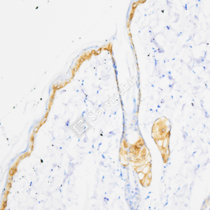 04 GB15803_Cytokeratin 14_ZSM19027_d1000_R skin_20.0x_IHC.png