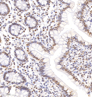 02 GB120001_PMS2_8F11H3-1_d3000_H small intestine_30.0x_IHC.png