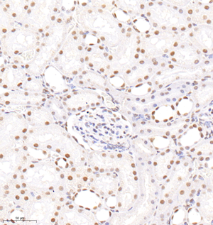 07 GB120001_PMS2_8F11H3-1_d3000_R kidney_30.0x_IHC.png