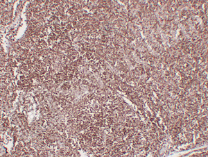 GB14029_图片1_IHC_WM.jpg