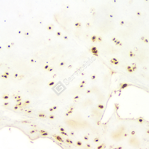 05 GB11500_OPN_d100_H bone_20x_IHC.jpg