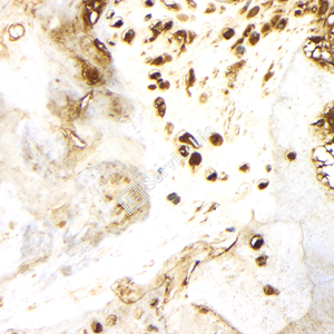 06 GB11500_OPN_d500_H bone_40x_IHC.jpg