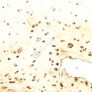 07 GB11500_OPN_d500_H bone_20x_IHC.jpg