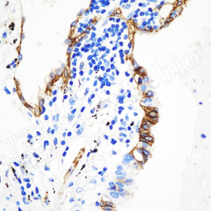 12 GB11529_AQP4_d600_H lung_40x_IHC.jpg