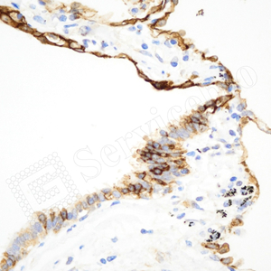 09 GB12529_AQP4_d1000_H lung_40x_IHC.jpg